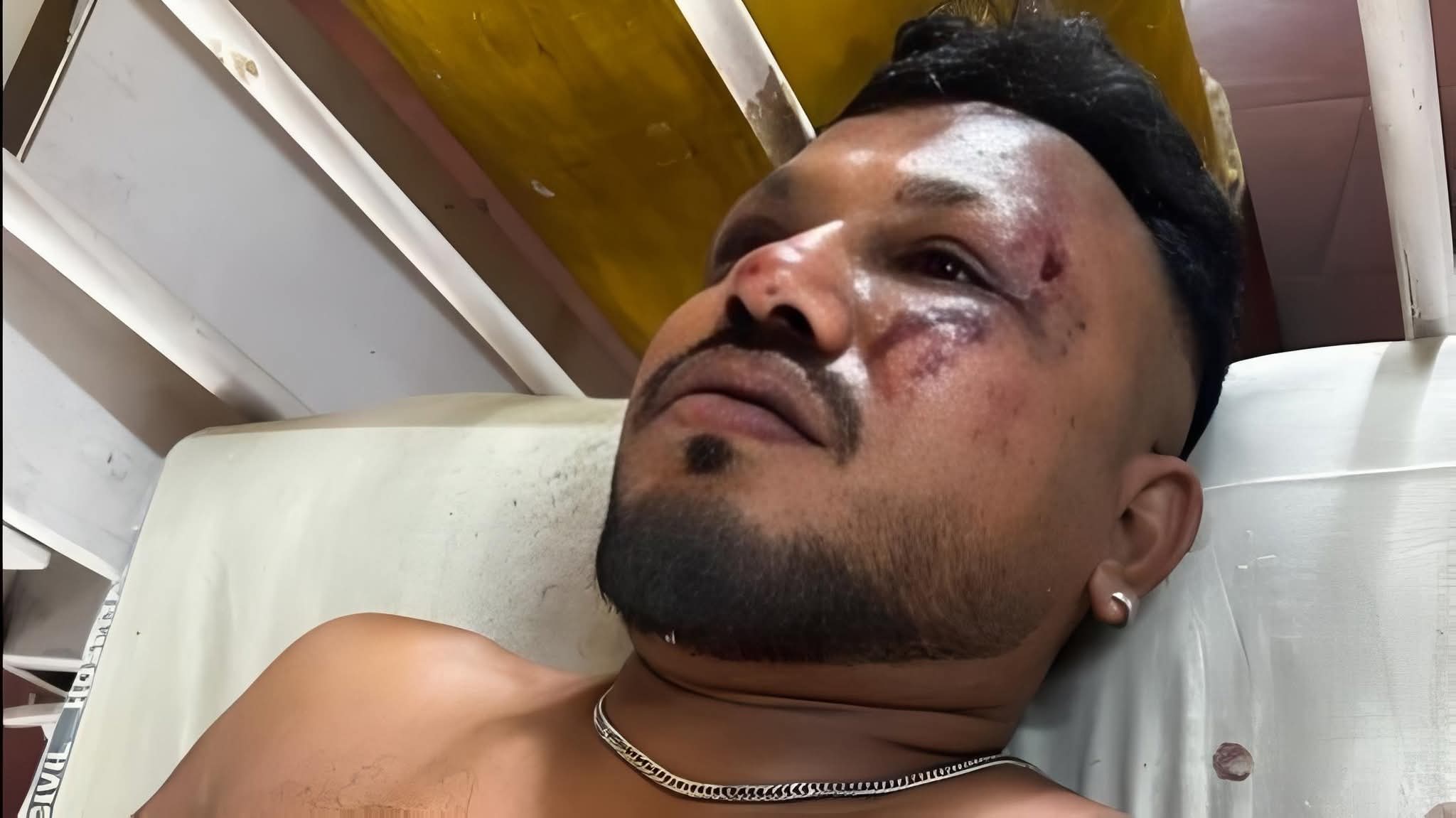 അഹമ്മദാബാദ് വിമാന ദുരന്തത്തില്‍ 40 കാരന്‍ അത്ഭുതകരമായി രക്ഷപ്പെട്ടു