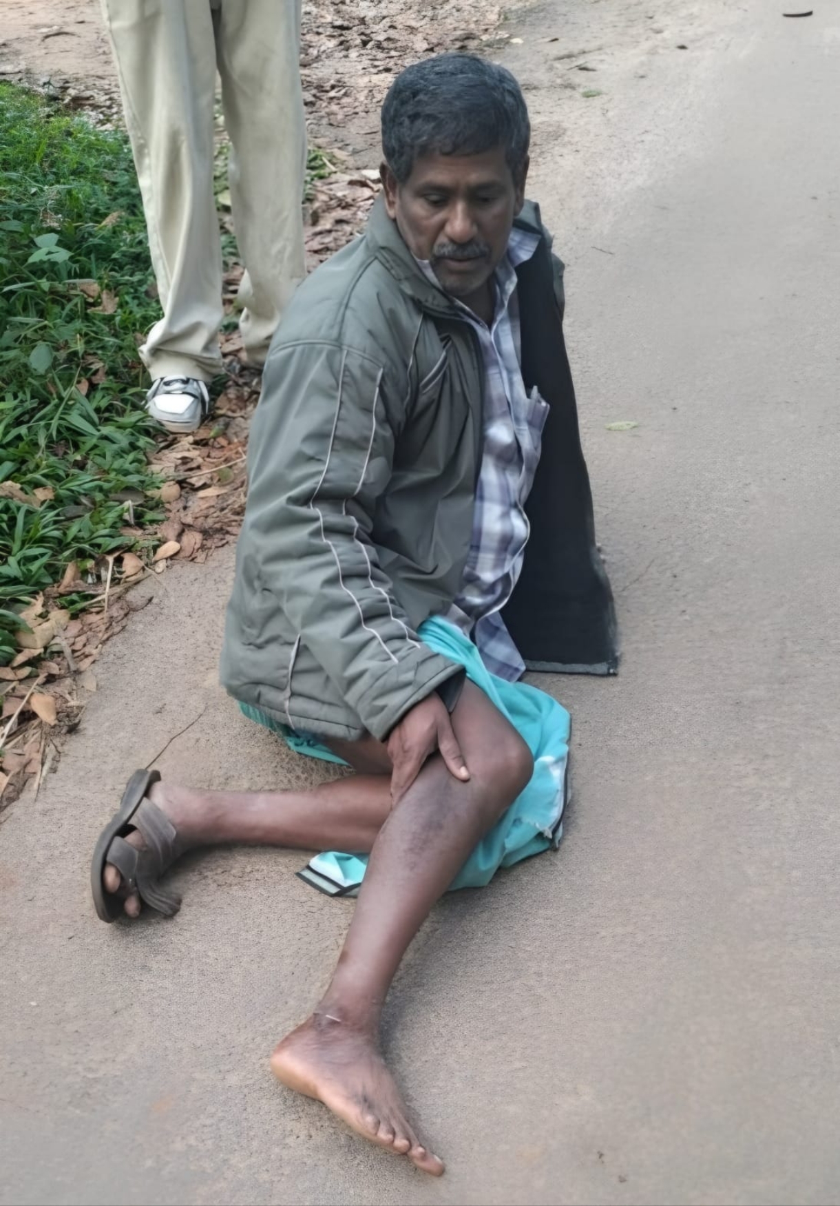 ബൈക്ക് യാത്രയ്ക്കിടെ തെരുവുനായയുടെ ആക്രമണം; മധുര സ്വദേശിക്ക് കടിയേറ്റു