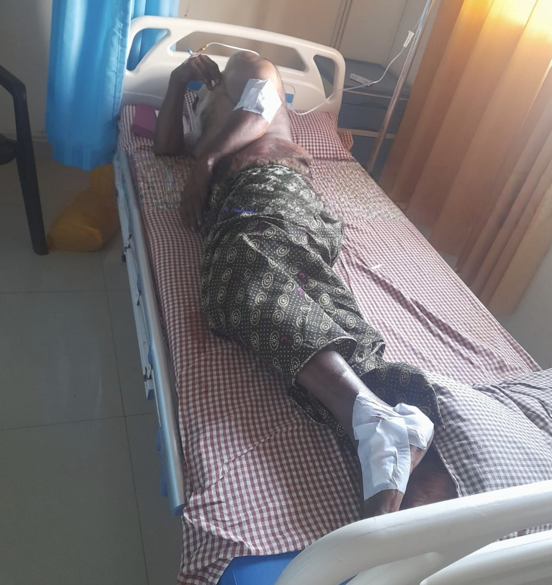 കാട്ടുപന്നി കുറുകെ ചാടി ഓട്ടോറിക്ഷ മറിഞ്ഞ് ഡ്രൈവർക്ക് പരിക്കേറ്റു.